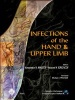 Infections of the Hand and Upper Limb (Hardcover) - Konstantinos Malizos Photo