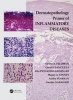 Dermatopathology Primer of Inflammatory Diseases (Paperback) - Steven R Feldman Photo