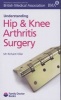 Understanding Hip & Knee Arthritis Surgery (Paperback) - Richard N Villar Photo