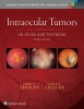 Intraocular Tumors: An Atlas and Textbook (Hardcover, 3rd Revised edition) - Jerry A Shields Photo