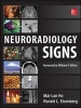 Neuroradiology Signs (Paperback) - Mai Lan Ho Photo