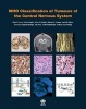 WHO Classification of Tumours of the Central Nervous System (Paperback, 4th Revised edition) - International Agency for Research on Cancer Photo