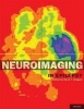 Neuroimaging in Epilepsy (Hardcover) - Harry Chugani Photo