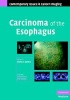 Carcinoma of the Esophagus (Hardcover, New) - Sheila C Rankin Photo