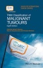 TNM Classification of Malignant Tumours (Paperback, 8th Revised edition) - James D Brierley Photo