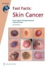 Fast Facts: Skin Cancer (Paperback, 2nd edition) - Karen L Agnew Photo