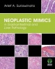 Neoplastic Mimics in Gastrointestinal and Liver Pathology (Hardcover) - Arief A Suriawinata Photo