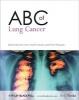 ABC of Lung Cancer (Paperback) - Ian Hunt Photo