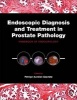 Endoscopic Diagnosis and Treatment in Prostate Pathology - Handbook of Endourology (Hardcover) - Petrisor Aurelian Geavlete Photo