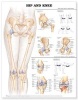 Hip and Knee Anatomical Chart (Wallchart, 2nd Revised edition) - Anatomical Chart Company Photo