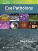 Eye Pathology - An Atlas and Text (Hardcover, 3rd Revised edition) - Ralph C Eagle Photo