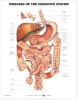 Diseases of the Digestive System Anatomical Chart (Wallchart) - Anatomical Chart Company Photo