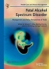 Fetal Alcohol Spectrum Disorder - Management and Policy Perspectives of FASD (Hardcover) - Edward P Riley Photo