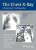 The Chest X-Ray - A Systematic Teaching Atlas (Paperback) - Matthias Hofer Photo