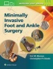 Minimally Invasive Foot & Ankle Surgery (Hardcover) - Christopher Chiodo Photo