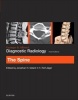 Grainger & Allison's Diagnostic Radiology: The Spine (Paperback, 6th Revised edition) - Jonathan H Gillard Photo