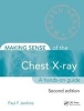 Making Sense of the Chest X-Ray - A Hands-on Guide (Paperback, 2nd Revised edition) - Paul F Jenkins Photo