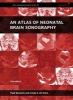 An Atlas of Neonatal Brain Sonography (Hardcover, 2nd Revised edition) - Paul Govaert Photo