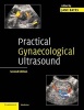 Practical Gynaecological Ultrasound (Paperback, 2nd Revised edition) - Jane Bates Photo