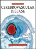 Principles of Cerebrovascular Disease (Hardcover, New) - Harold S Adams Photo