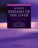 Schiff's Diseases of the Liver (Hardcover, 11th Revised edition) - Eugene R Schiff Photo