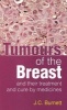 Tumours of the Breast - & Their Treatment & Cure by Medicines (Paperback) - JC Burnett Photo