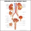 Diseases of the Urinary Tract Anatomical Chart (Wallchart) - Anatomical Chart Company Photo