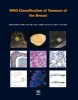 WHO Classification of Tumours of the Breast (Paperback, 4th Revised edition) - SR Lakhani Photo