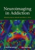 Neuroimaging in Addiction (Hardcover) - Bryon Adinoff Photo