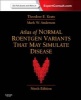 Atlas of Normal Roentgen Variants That May Simulate Disease (Hardcover, 9th Revised edition) - Theodore E Keats Photo