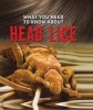 What You Need to Know About Head Lice (Hardcover) - Nancy Dickmann Photo