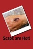 Scabs Are Hot! - A 6 X 9 Lined Journal (Paperback) - Irreverent Journals Photo