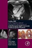 The Cardiac MRI in Diagnosis, Clinical Management, and Prognosis of Arrhythmogenic Right Ventricular Cardiomyopathy/Dysplasia (Paperback) - Aiden Abidov Photo