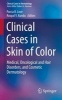 Clinical Cases in Skin of Color 2016 - Medical, Oncological and Hair Disorders, and Cosmetic Dermatology (Paperback) - Roopal V Kundu Photo