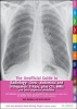 The Unofficial Guide to Radiology: Chest, Abdominal and Orthopaedic X Rays, Plus CTs, MRIs and Other Important Modalities - Core Radiology Curriculum. 100 Annotated X-Rays (Including How to Present Them). 300 Multiple Choice Questions (with Detailed Expla Photo