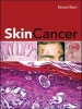 Skin Cancer (Hardcover) - Keyvan Nouri Photo