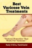 Best Varicose Vein Treatments - Natural Remedies That Work for Varicose (Large print, Paperback, large type edition) - Rudy Silva Silva Photo