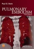 Pulmonary Embolism (Hardcover, 3rd Revised edition) - Paul D Stein Photo