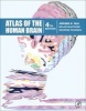 Atlas of the Human Brain (Hardcover, 4th Revised edition) - Juergen K Mai Photo