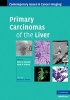 Primary Carcinomas of the Liver (Hardcover) - Hero K Hussain Photo