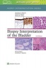 Biopsy Interpretation of the Bladder (Hardcover, 3rd Revised edition) - Jonathan Epstein Photo