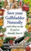 Save your gallbladder naturally - And What to Do If You've Already Lost it (Paperback) - Sandra Cabot Photo