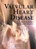 Valvular Heart Disease (Paperback) - Bruce W Andrus Photo