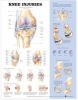 Knee Injuries Anatomical Chart (Wallchart, New edition) - Anatomical Chart Company Photo