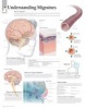 Understanding Migraines (Poster) - Scientific Publishing Photo