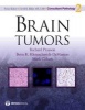 Brain Tumors (Hardcover) - Richard Prayson Photo