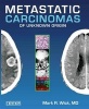 Metastatic Carcinomas of Unknown Origin (Hardcover) - Mark R Wick Photo