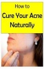 How to Cure Your Acne Naturally (Paperback) - Dr Asif Kamal Photo