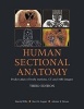 Human Sectional Anatomy - Pocket Atlas of Body Sections, CT and MRI Images (Paperback, 3rd Revised edition) - Harold Ellis Photo