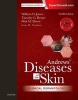 Andrews' Diseases of the Skin - Clinical Dermatology (Hardcover, 12th Revised edition) - William D James Photo